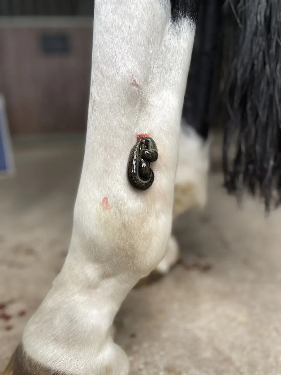 Hirudotherapie